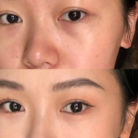 TRIPLE ACTION LIGHTENING CREAM